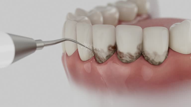 Trusted Teeth Cleaning And Checkup service in Charter Oak, CA - Dentist Open Now